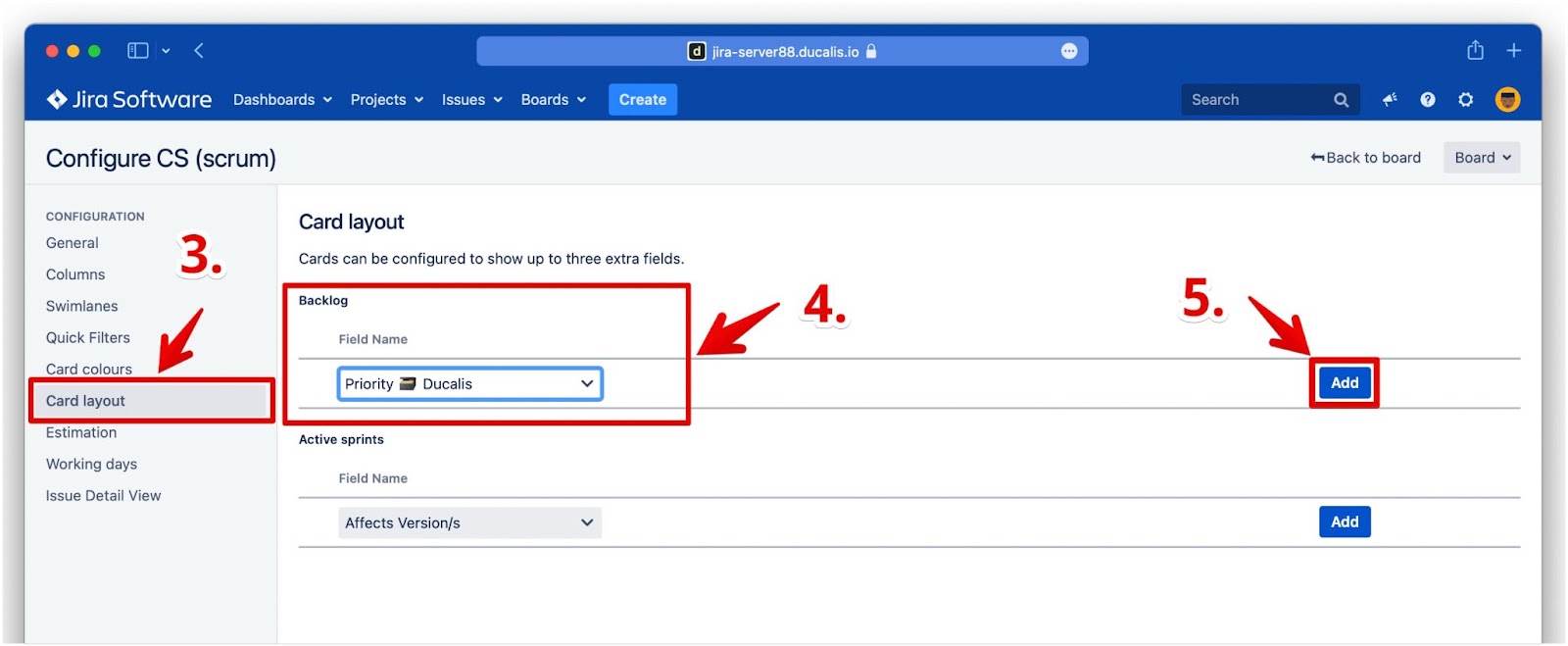 Backlog-Kartenlayout-Konfiguration