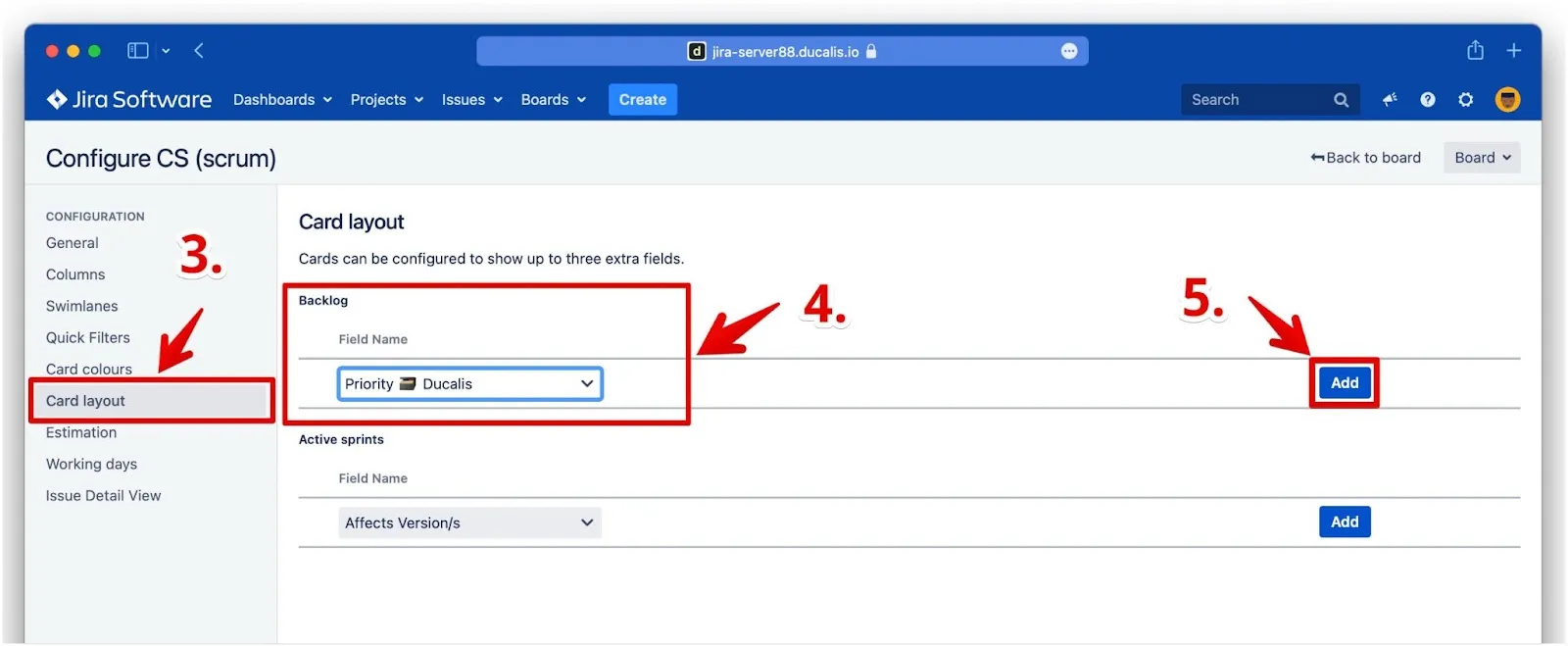 バックログのカードレイアウト設定